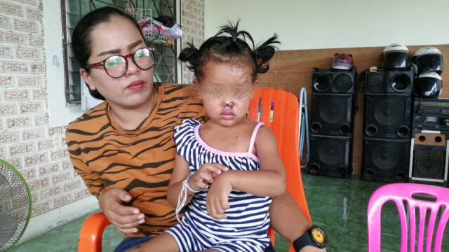 แม่ยันเอาเรื่องหนุ่มหัวร้อน ขับกระบะชนลูกบาดเจ็บ-พี่สาหัส