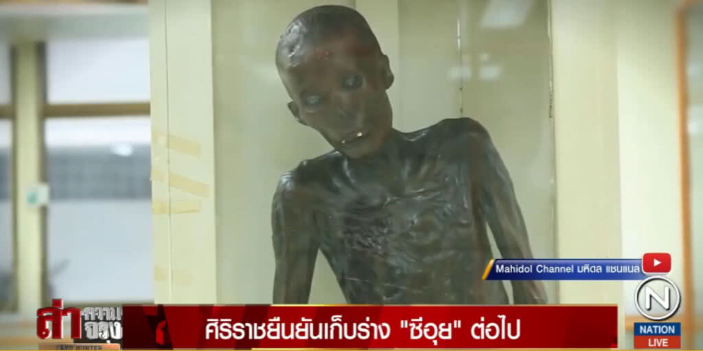 ศิริราชยืนยันเก็บร่าง "ซีอุย" ต่อไป