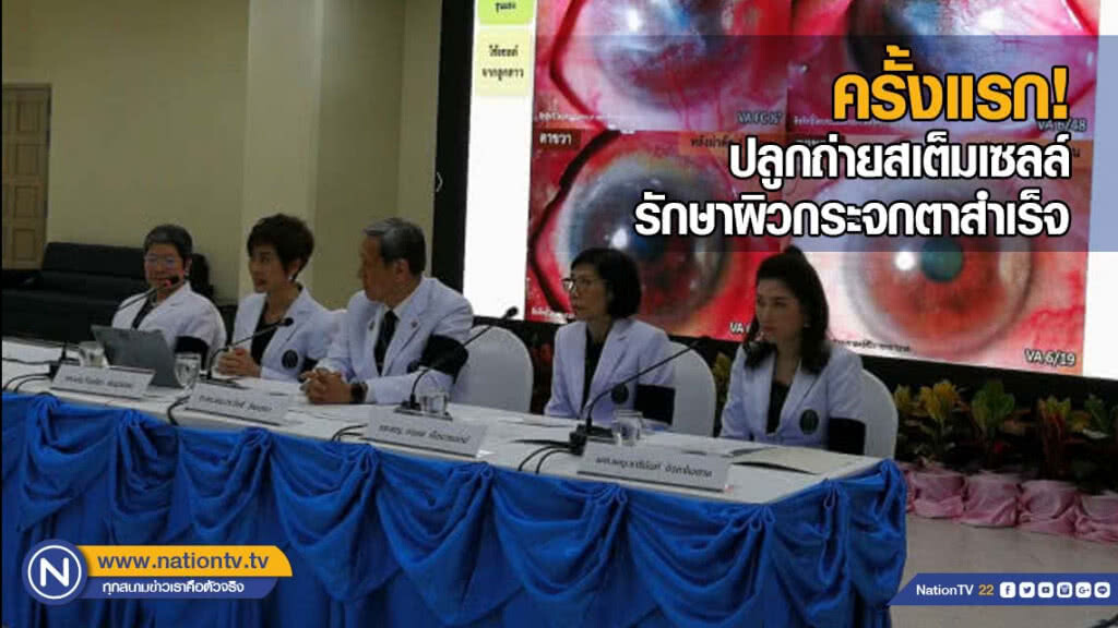 "ศิริราช" ปลูกถ่ายสเต็มเซลล์รักษาผิวกระจกตาสำเร็จครั้งแรกของไทย "ศิริราช" ปลูกถ่ายสเต็มเซลล์รักษาผิวกระจกตาสำเร็จครั้งแรกของไทย