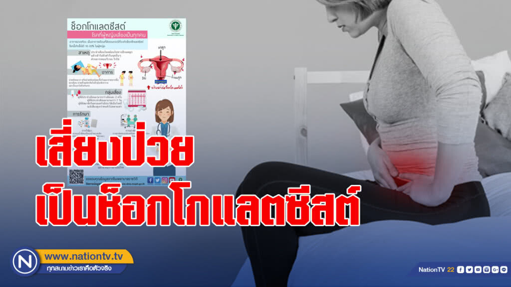แพทย์เตือน อาการปวดท้องรุนแรงเมื่อมีประจำเดือน เสี่ยงป่วยเป็นช็อกโกแลตซีสต์