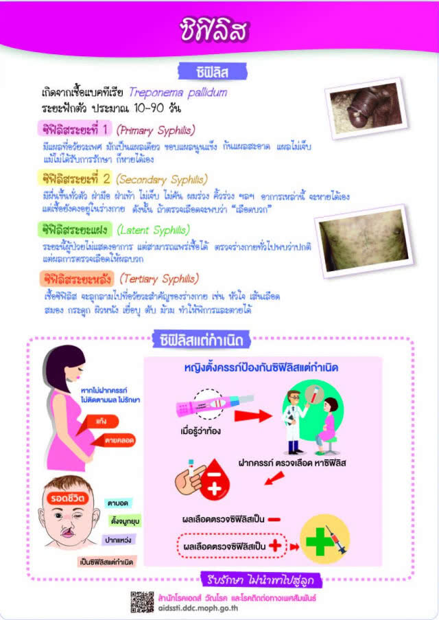 สธ.เผยตัวเลขผู้ป่วยซิฟิลิส​ปี​ 62​ พุ่ง​ 3,752 ราย หนองใน 3,940 ราย แนวโน้มเพิ่มขึ้น​ สั่งแจกถุงยางฯ