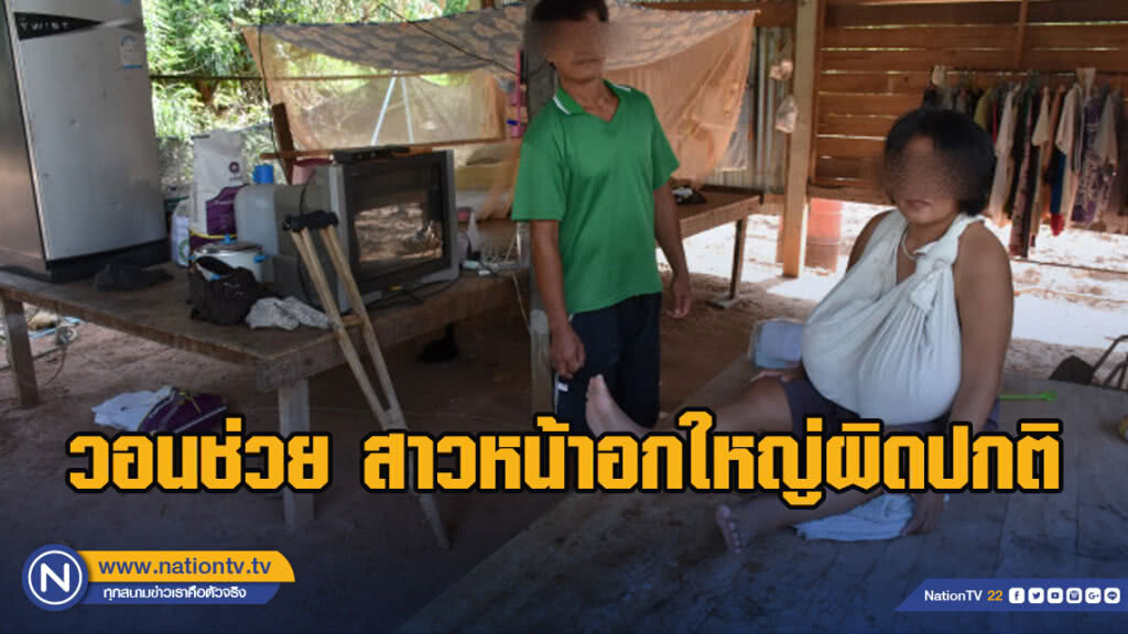 วอนช่วย สาวหน้าอกใหญ่ผิดปกติ ใช้ชีวิตลำบาก!!