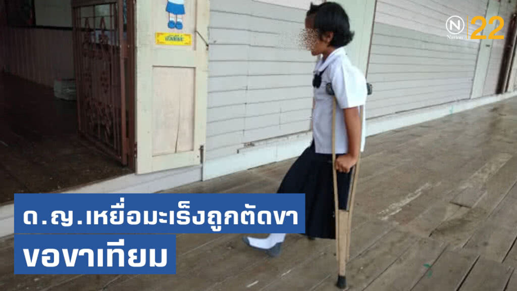 สู้ไม่ถอย!! เด็กหญิงเหยื่อมะเร็งถูกตัดขา ขอขาเทียม