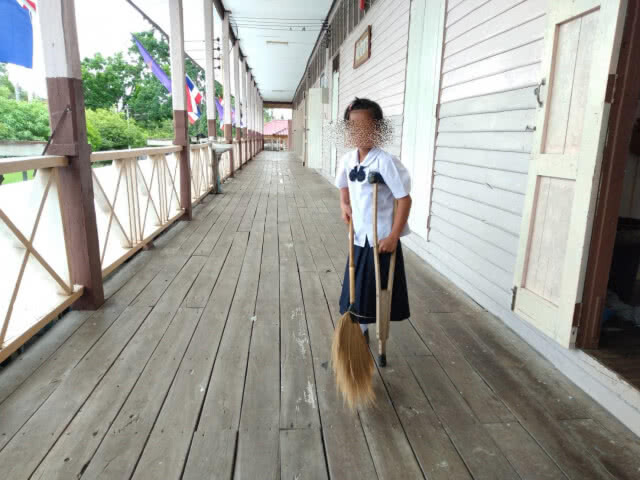 สู้ไม่ถอย!! เด็กหญิงเหยื่อมะเร็งถูกตัดขา ขอขาเทียม