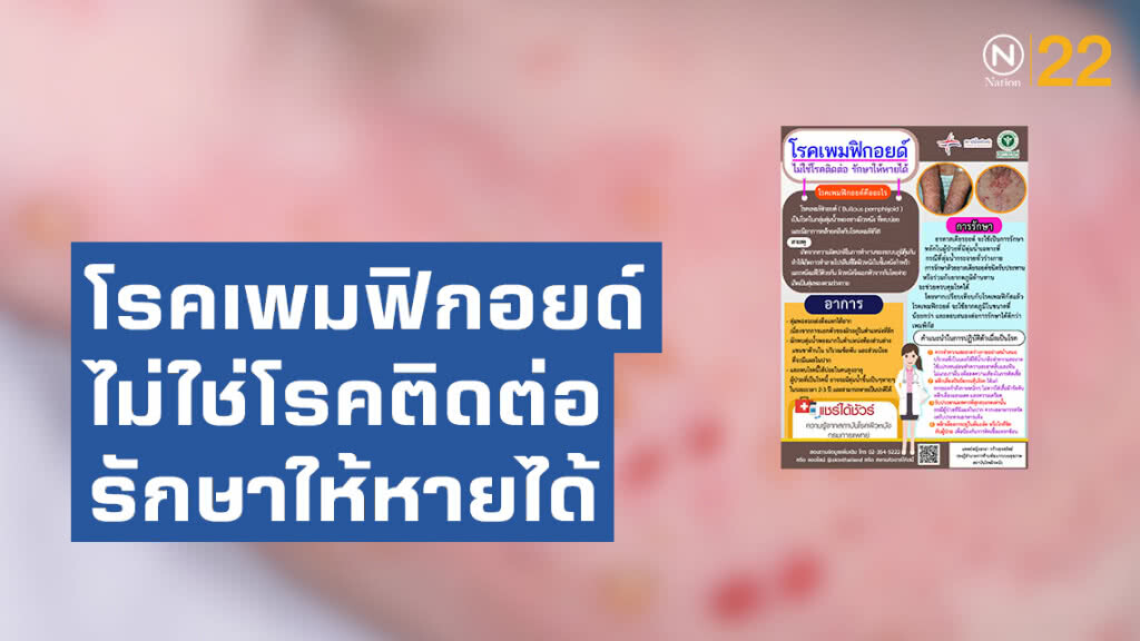 แพทย์ผิวหนังชี้ โรคเพมฟิกอยด์ ไม่ใช่โรคติดต่อ รักษาให้หายได้