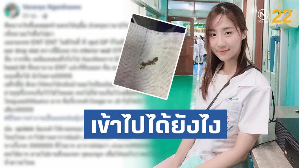 คุณหมอ สุดตะลึง!! เจอจิ้งจกตัวเป็นๆติดอยู่ในหูคนไข้