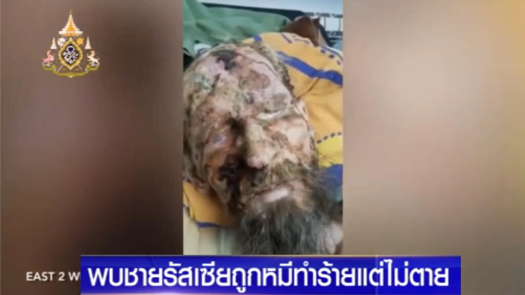 ปาฏิหาริย์มีจริง!....หลังชายรัสเซีย ถูกหมีทำร้าย แต่ไม่ตาย