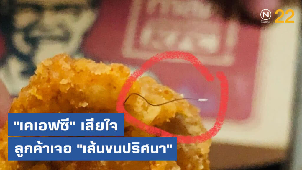"เคเอฟซี" เสียใจ ลูกค้าเจอ "เส้นขนปริศนา" ในชิ้นไก่ "เคเอฟซี" เสียใจ ลูกค้าเจอ "เส้นขนปริศนา" ในชิ้นไก่