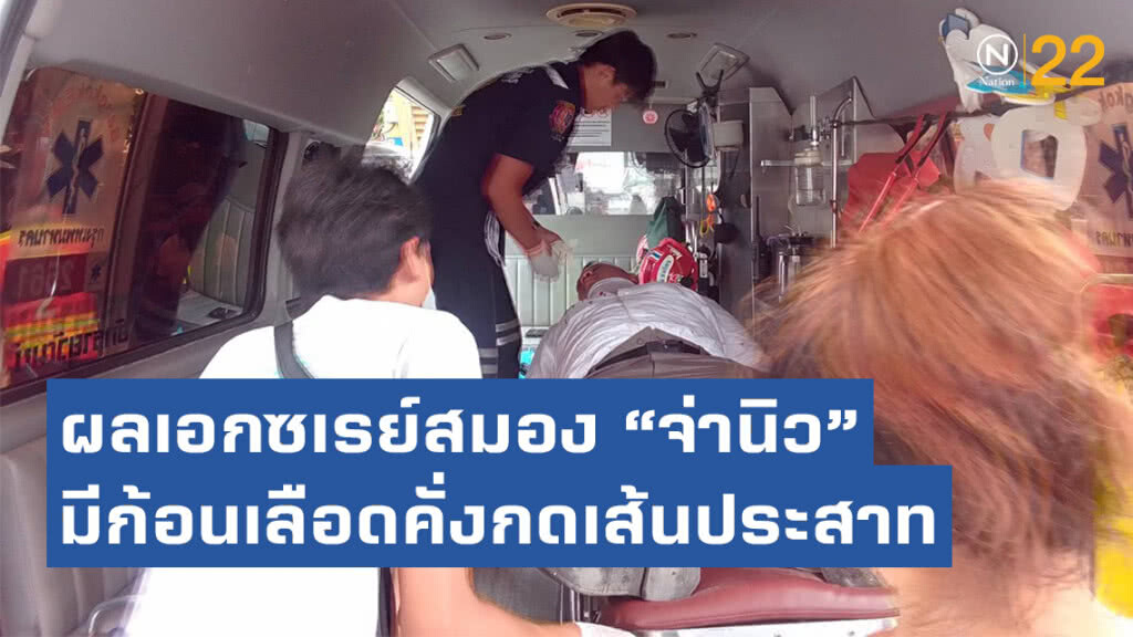 ผลเอกซเรย์สมอง "จ่านิว" มีก้อนเลือดคั่งกดเส้นประสาท