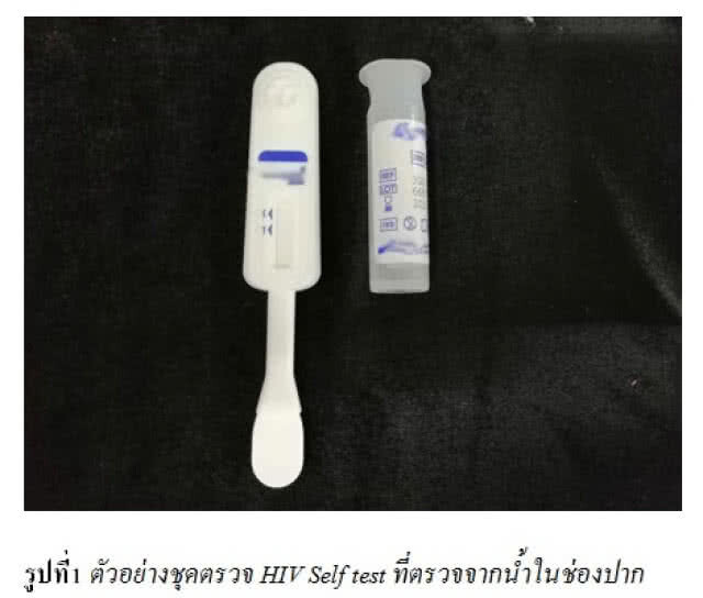 กรมวิทย์ฯ พร้อมประเมินคุณภาพชุดตรวจเอชไอวีสำหรับใช้ด้วยตนเอง