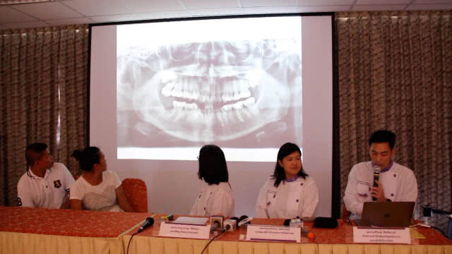 ผ่าออกแล้ว หัวกรอฟันที่ทันตแพทย์ลืมไว้ในเหงือกคนไข้ 5 ปี