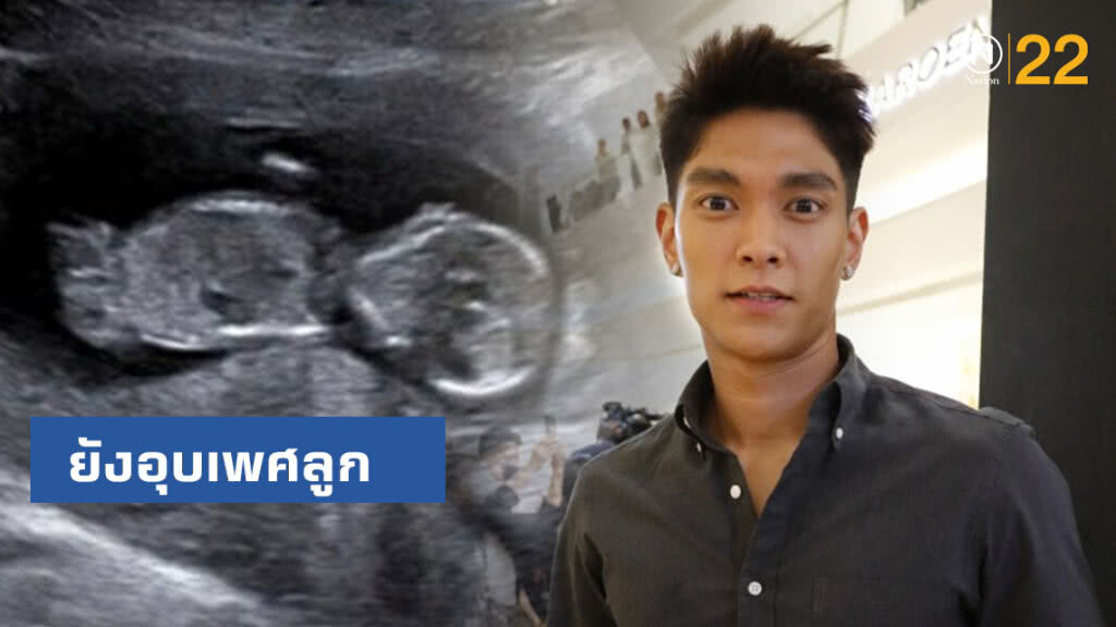 "มิกกี้" ยังอุบเพศลูก รอชัดเจน เผย "เจนี่" ตั้งท้อง 4 เดือนกว่า "มิกกี้" ยังอุบเพศลูก รอชัดเจน เผย "เจนี่" ตั้งท้อง 4 เดือนกว่า