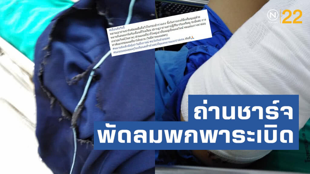 เตือนภัย!! ถ่านชาร์จพัดลมพกพาระเบิดไหม้คากระเป๋ากางเกงนักเรียน เตือนภัย!! ถ่านชาร์จพัดลมพกพาระเบิดไหม้คากระเป๋ากางเกงนักเรียน