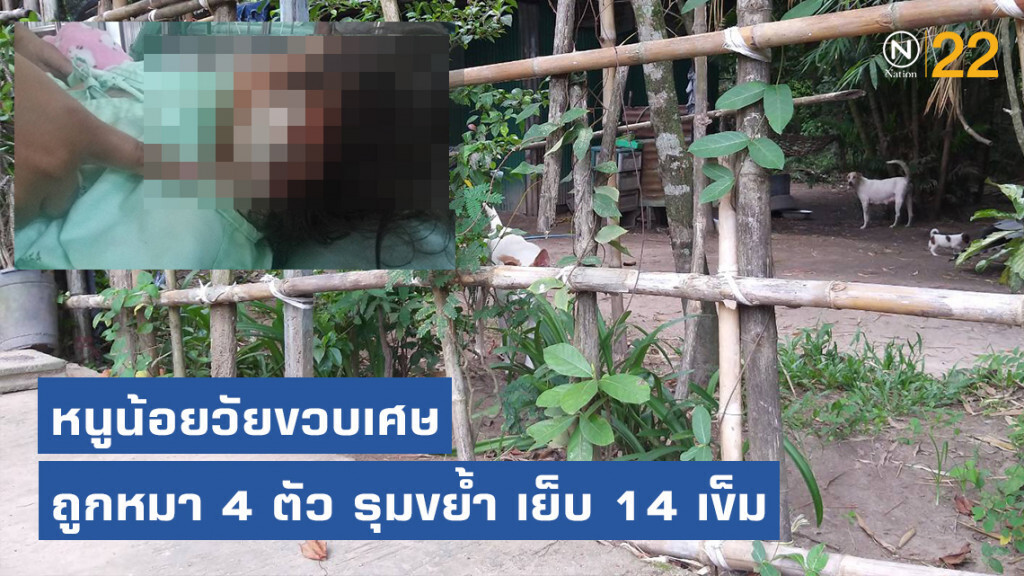 หมา 4 ตัว รุมขย้ำหนูน้อยวัยขวบเศษ ชาวบ้านเข้าช่วยไว้ได้ทัน เย็บไป 15 เข็ม