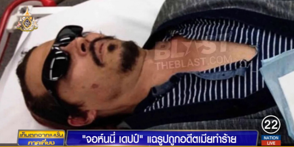 "จอห์นนี่ เดปป์" แฉถูกอดีตเมียทำร้าย ทั้งปาขวดใส่และเอาบุหรี่จี้แก้ม