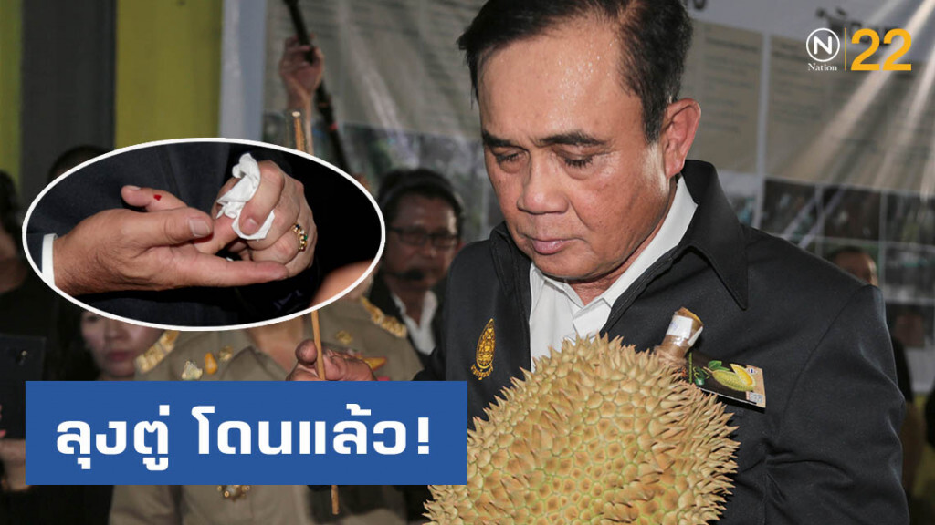 "ลุงตู่" โดนหนามทุเรียนบาดมือ "ลุงตู่" โดนหนามทุเรียนบาดมือ