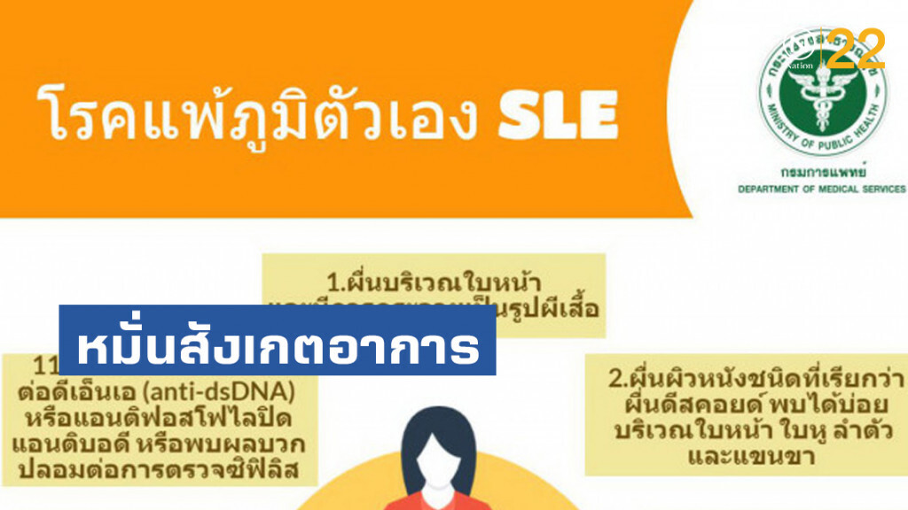 กรมการแพทย์แนะผู้ป่วยโรคแพ้ภูมิตัวเอง (SLE) หมั่นสังเกตอาการ หากพบความผิดปกติควรรีบพบแพทย์