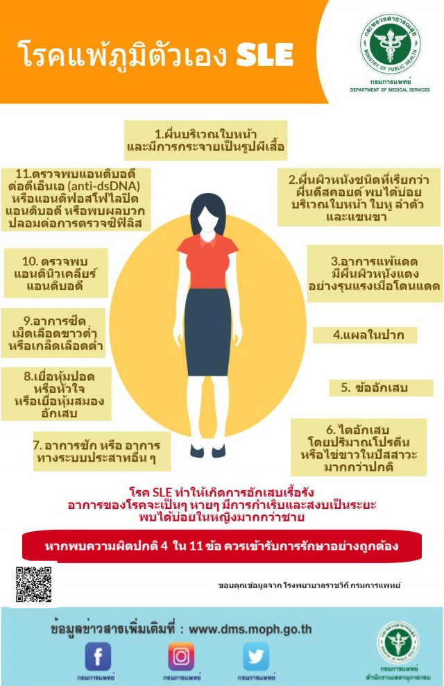 กรมการแพทย์แนะผู้ป่วยโรคแพ้ภูมิตัวเอง (SLE) หมั่นสังเกตอาการ หากพบความผิดปกติควรรีบพบแพทย์