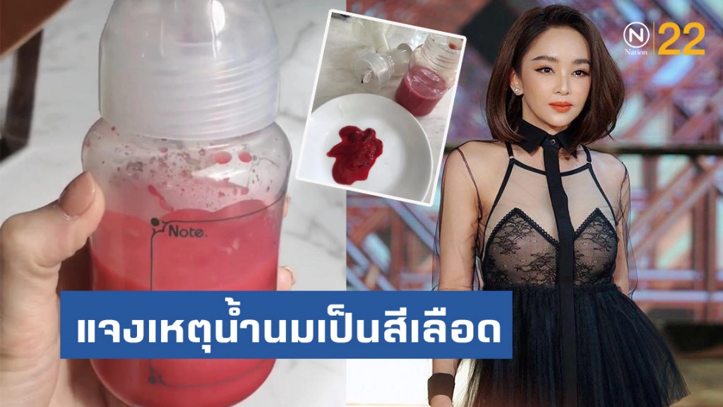 "เป้ย ปานวาด" แจงแล้ว!! สาเหตุน้ำนมเป็นสีเลือด