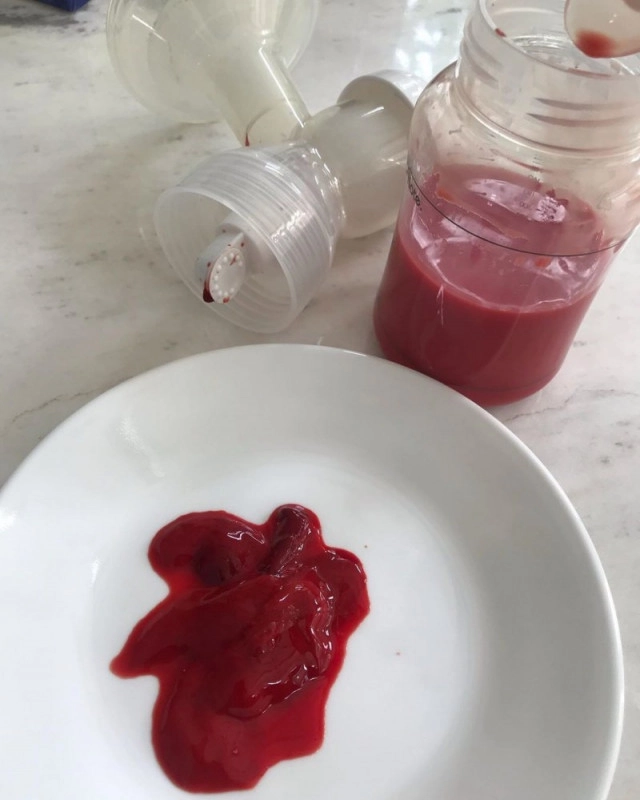 "เป้ย ปานวาด" แจงแล้ว!! สาเหตุน้ำนมเป็นสีเลือด