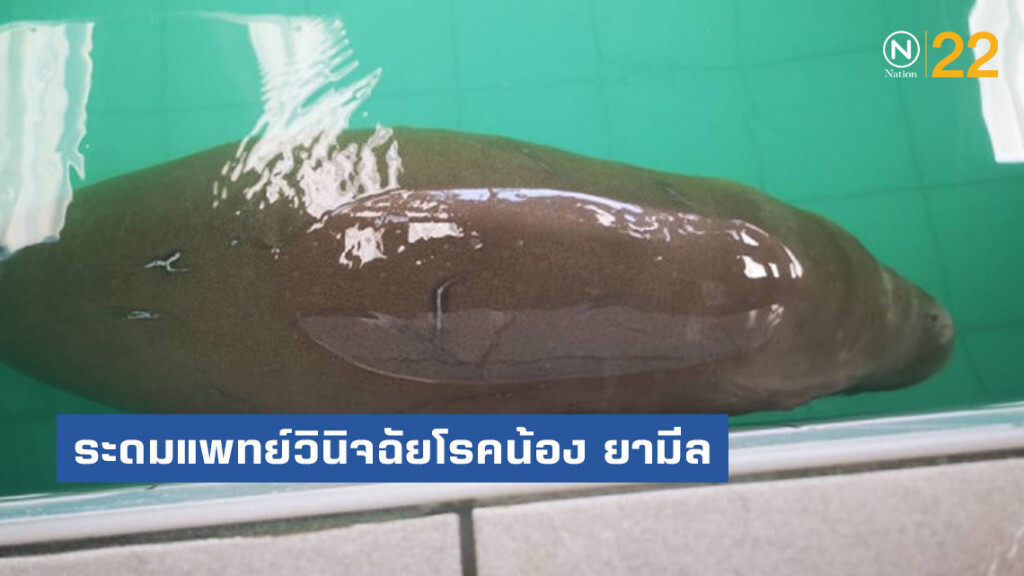 ระดมทีมแพทย์ภูเก็ต วินิจฉัยโรคน้อง ยามีล ระดมทีมแพทย์ภูเก็ต วินิจฉัยโรคน้อง ยามีล