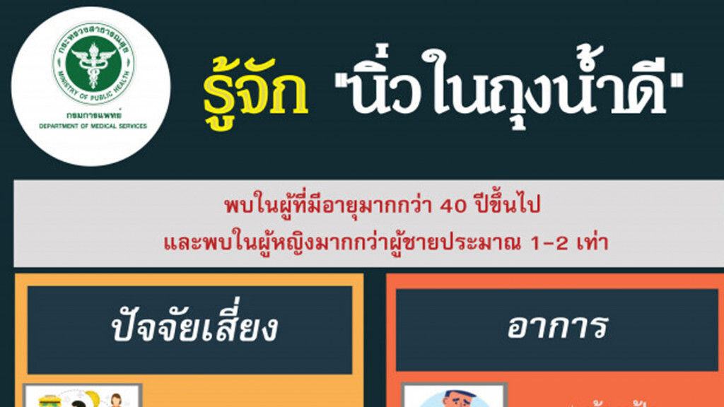 แพทย์ชี้ "นิ่วในถุงน้ำดี" พบในหญิงมากกว่าชาย  1-2  เท่า