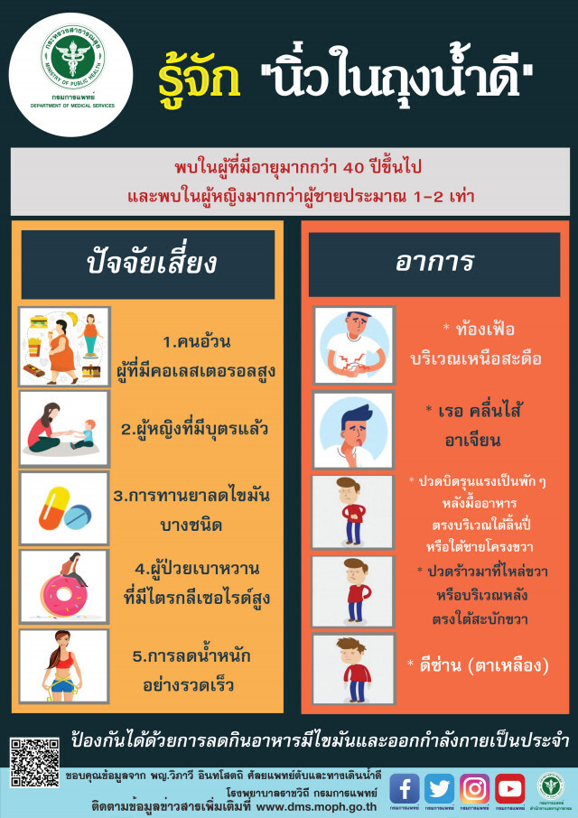แพทย์ชี้ "นิ่วในถุงน้ำดี" พบในหญิงมากกว่าชาย  1-2  เท่า
