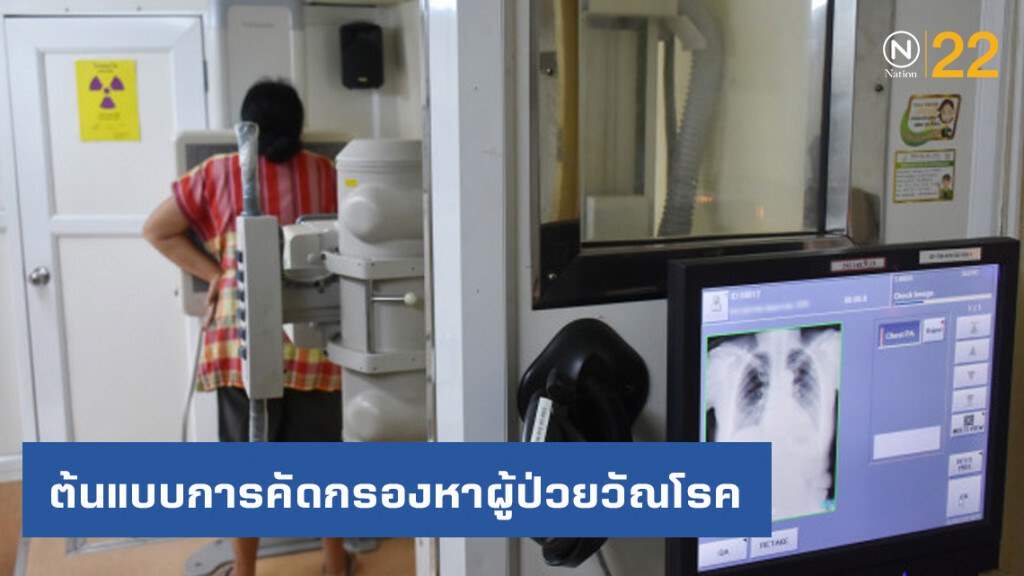 "บางกอกน้อยโมเดล" ต้นแบบการคัดกรองหาผู้ป่วยวัณโรค สู่การรักษาที่รวดเร็ว