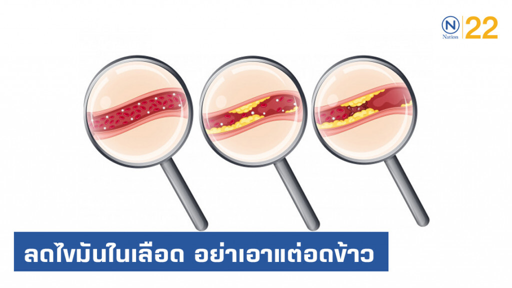 หมอแนะ ลดไขมันในเลือด อย่าเอาแต่อดข้าว