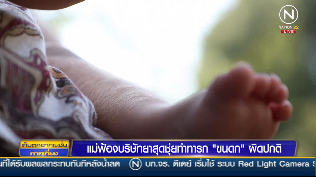 แม่ฟ้องบริษัทยาสุดชุ่ย ทำทารก "ขนดก" ผิดปกติ