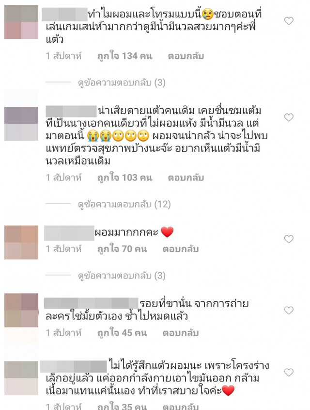 แฟนคลับห่วง "แต้ว" เสพติดความผอม