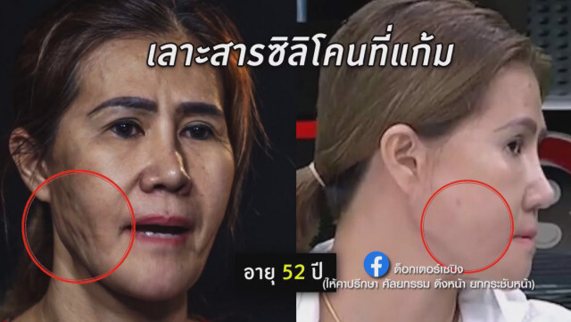"เซปิง-สุรชัย" งัดหลักฐานเด็ด แฉกลับครั้งแรก!!!