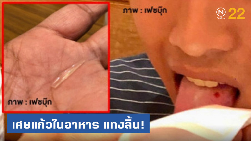 โพสต์เตือน! เศษแก้วปนในอาหารร้านดัง แทงลิ้น โพสต์เตือน! เศษแก้วปนในอาหารร้านดัง แทงลิ้น