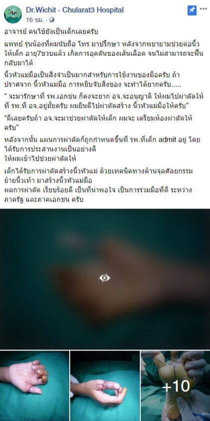 หมอไทยสุดยอด ผ่าตัดต่อนิ้วมือเด็ก 7 ขวบด้วยนิ้วเท้า