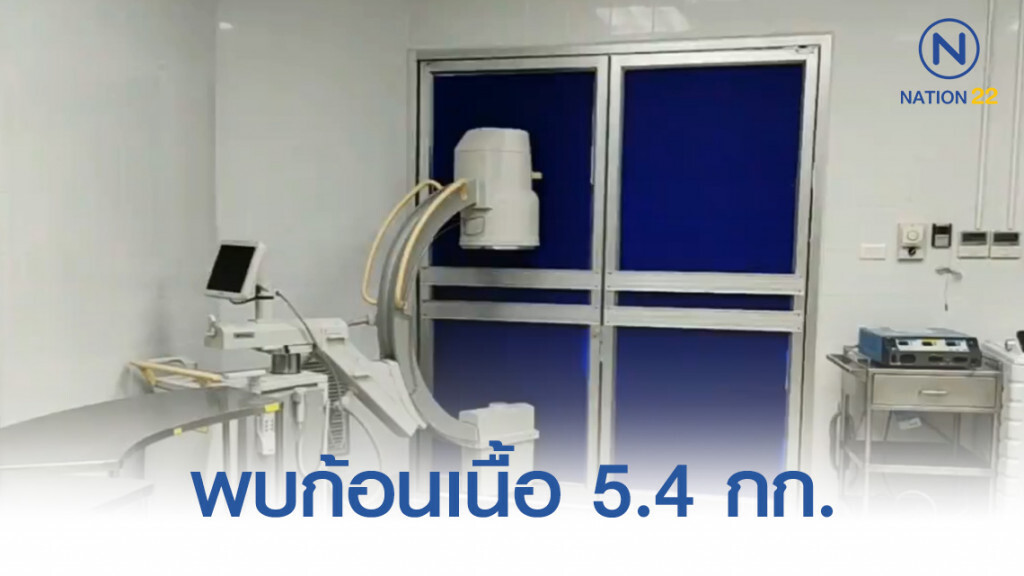 หมอตะลึง! พบก้อนเนื้อในช่องท้องผู้ชาย 5.4 กิโล