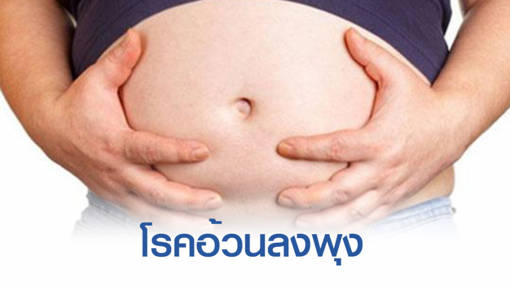 เตือน! ชายรอบเอวเกิน 36 นิ้ว / หญิงเกินกว่า 32 นิ้ว จัดเป็นโรคอ้วนลงพุง