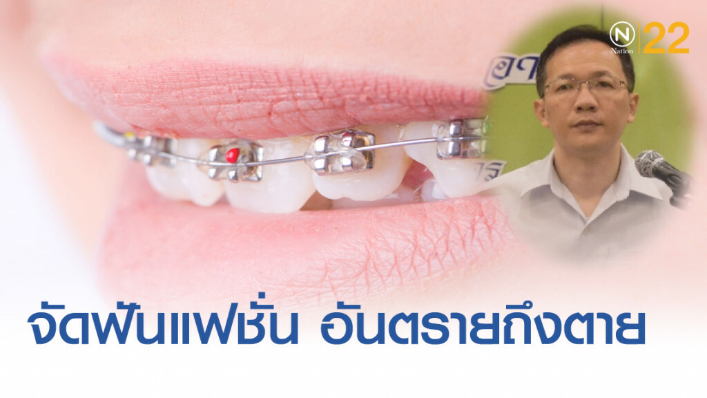 "จัดฟันแฟชั่น" ในคลินิกเถื่อน เสี่ยงติดเชื้อ อันตรายถึงชีวิต