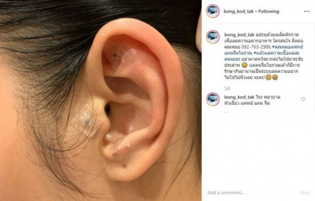 "ตั๊ก บงกช" รับมีตัวช่วยลดความอ้วน