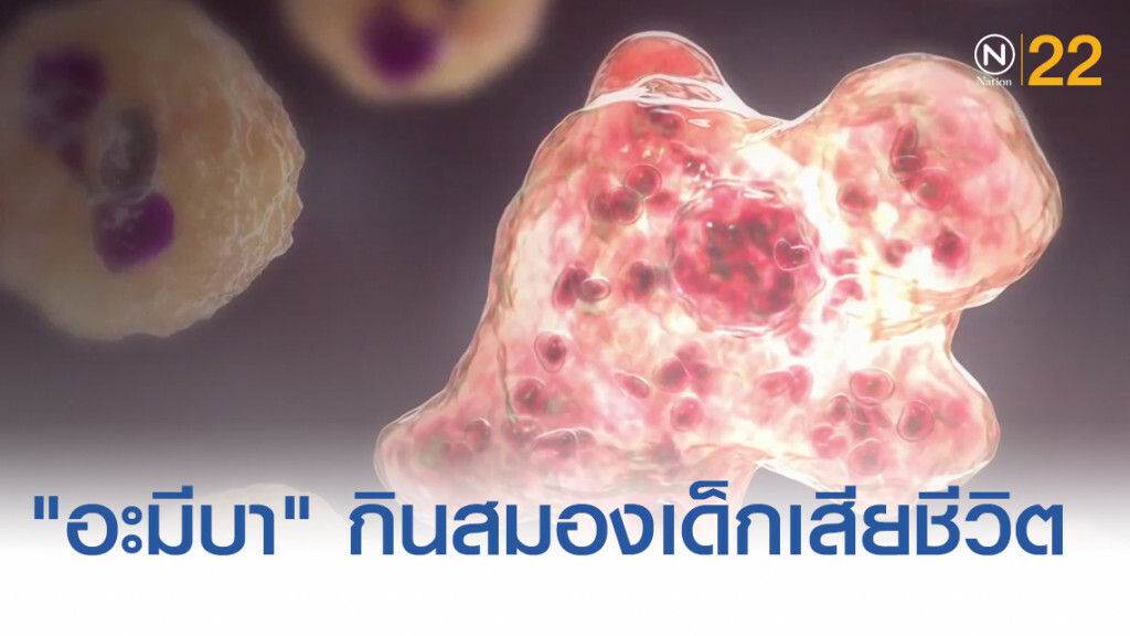 เด็ก 10 ขวบเสียชีวิตหลัง "อะมีบา" กินสมองขณะว่ายน้ำ