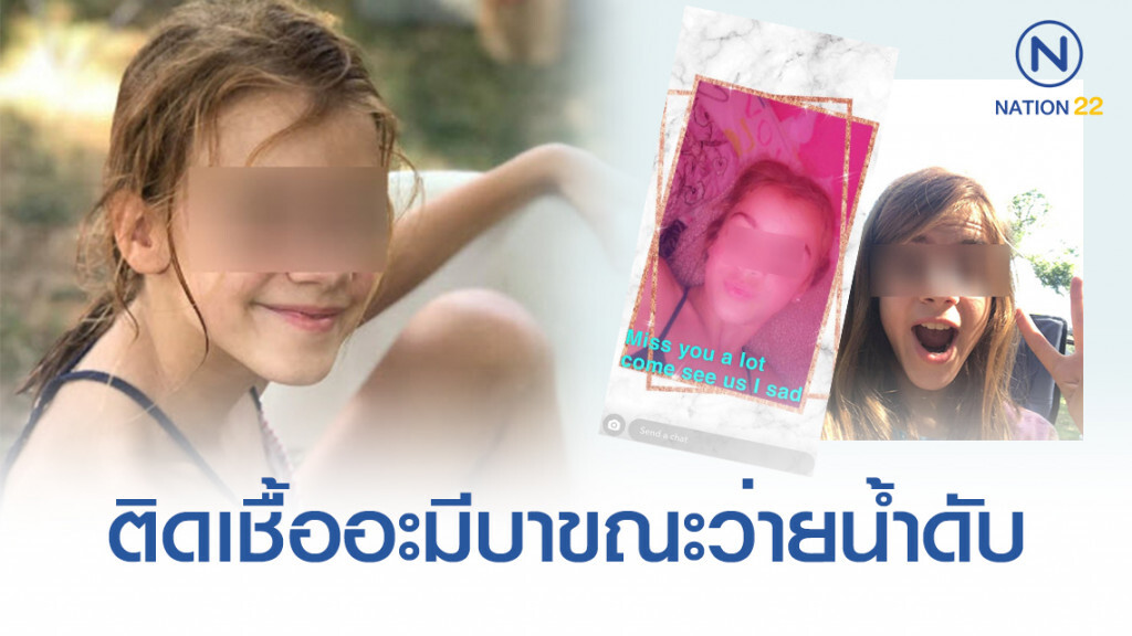 เคราะห์ร้าย! เด็กหญิง 10 ขวบติดเชื้ออะมีบาขณะว่ายน้ำ กินสมองดับ