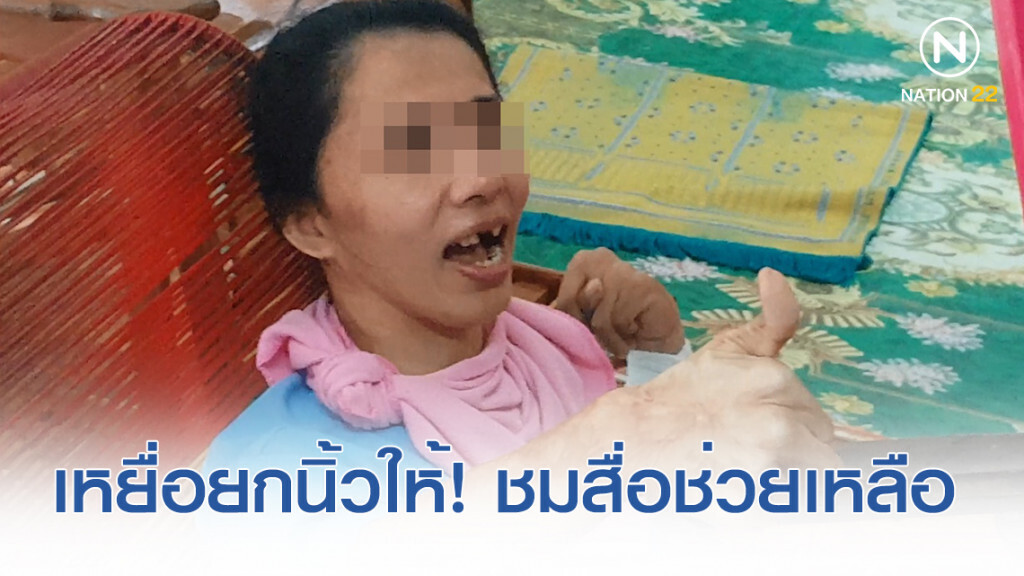เหยื่อยกนิ้วชมสื่อ! ช่วยเหลือถูกทำร้าย 17  ปี หลังคดีไม่คืบ