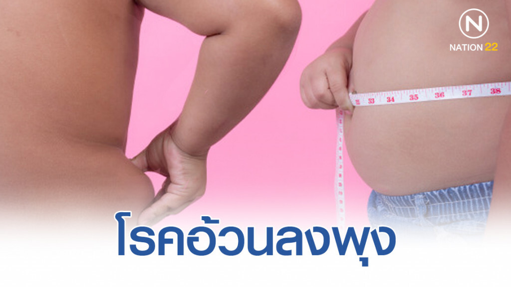 เตือน! ชายรอบเอวเกิน 36 นิ้ว / หญิงเกินกว่า 32 นิ้ว จัดเป็นโรคอ้วนลงพุง