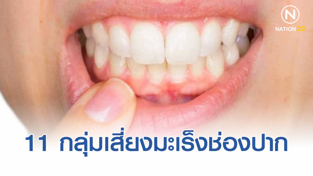 11 กลุ่มเสี่ยงมะเร็งช่องปาก