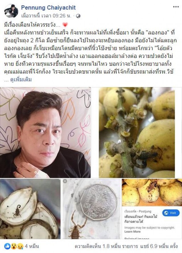หนุ่มโพสต์เตือน "พิษร้ายแรง!" ที่มากับพวงลองกอง