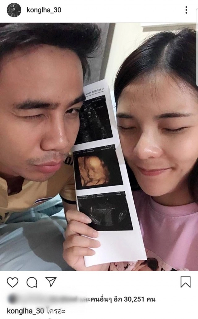 "ก้อง - เบล " ลูกคนที่ 2 มาเเล้ว เเฟนคลับเเห่กันยินดี