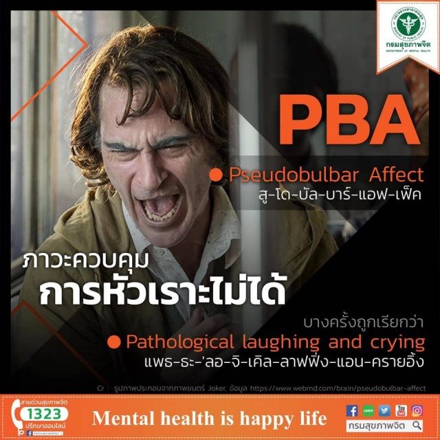 กรมสุขภาพจิต เตือน "ภาวะควบคุมการหัวเราะไม่ได้" จากการดู "Joker"