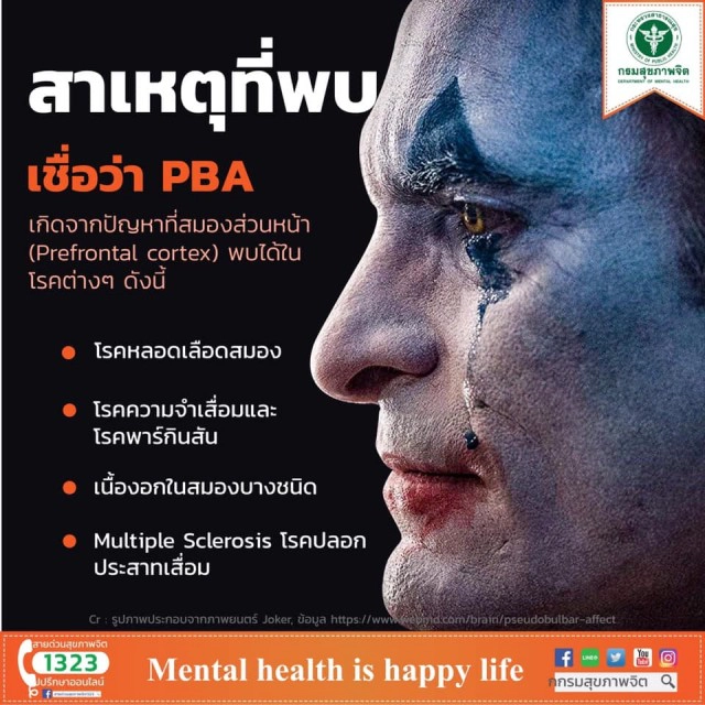 กรมสุขภาพจิต เตือน "ภาวะควบคุมการหัวเราะไม่ได้" จากการดู "Joker"