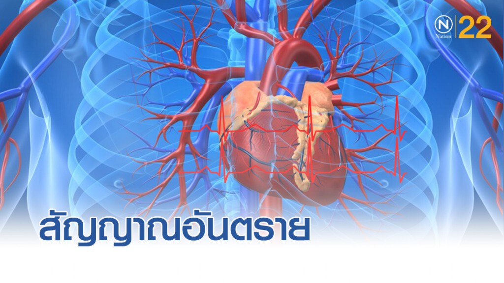 แพทย์แนะวิธีการดูแลหัวใจให้แข็งแรง อันตรายหากพบเจ็บแน่นหน้าอก