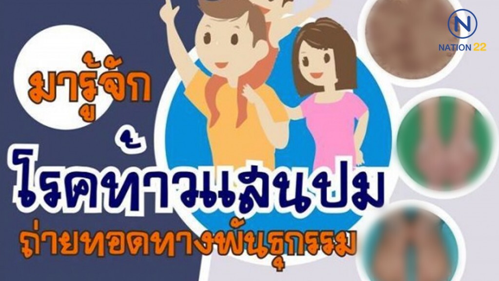 "โรคท้าวแสนปม" ไม่ใช่โรคติดต่อ วอนสังคมอย่ารังเกียจ