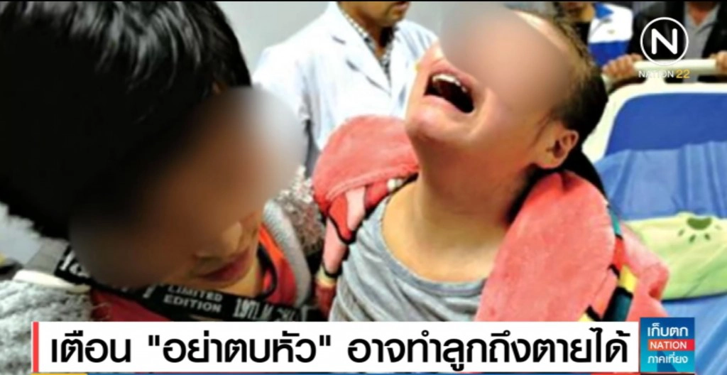 เตือน "อย่าตบหัว" อันตรายอาจถึงเสียชีวิต